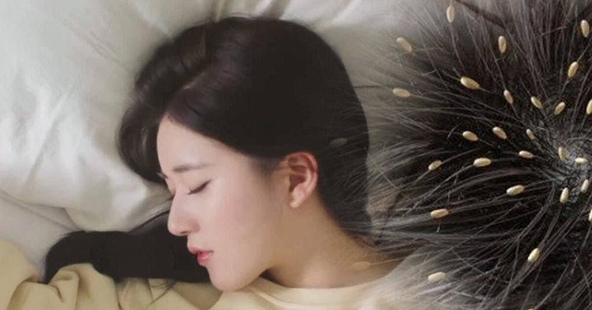 ฝันเห็นเหาอยู่บนหัว เลขเด็ด